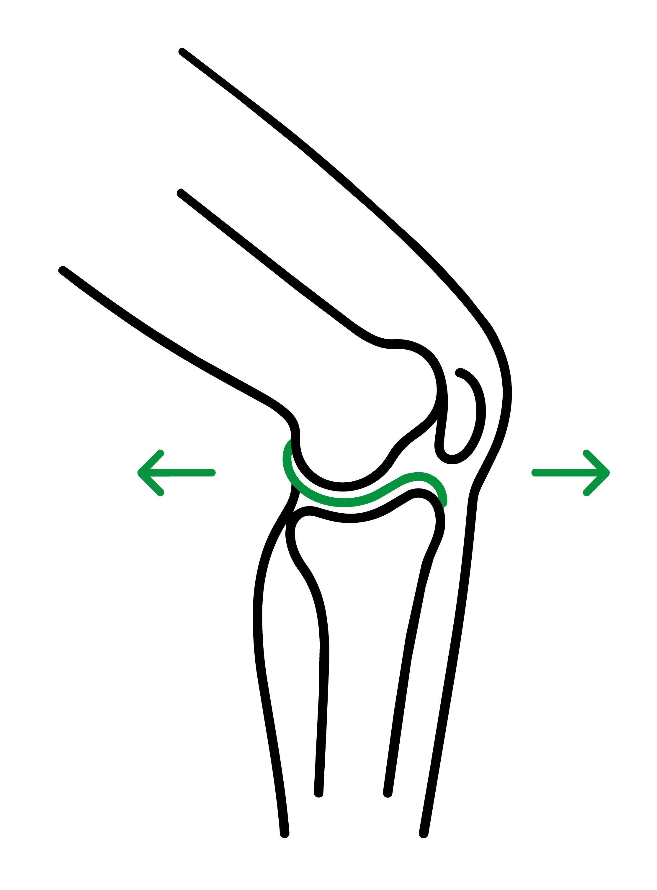 A silhouette of a surgical or dental instrument with curved ends, featuring green arrows pointing left and right, on a black background.