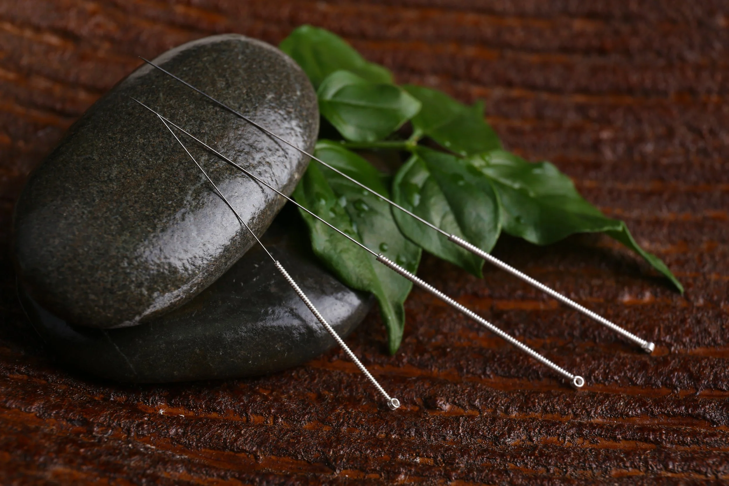 Acupuncture needles in a calming holistic treatment setting at Te Tīeke Wellington