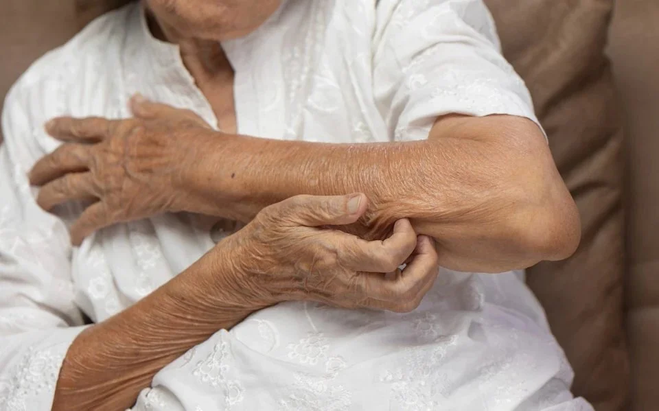 A person experiencing the proud elbow effect.