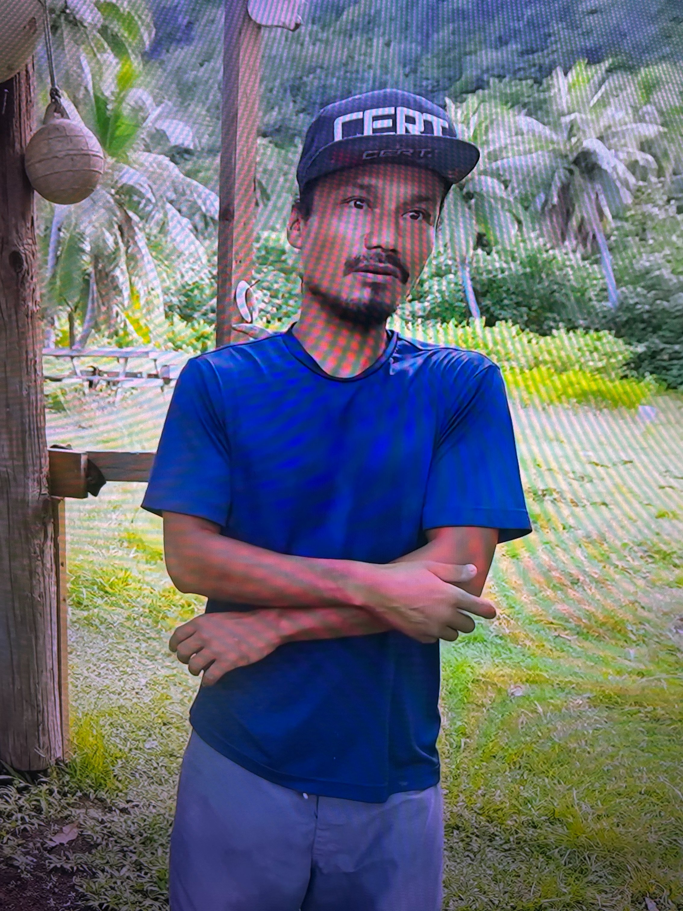 A person experiencing the proud elbow effect.