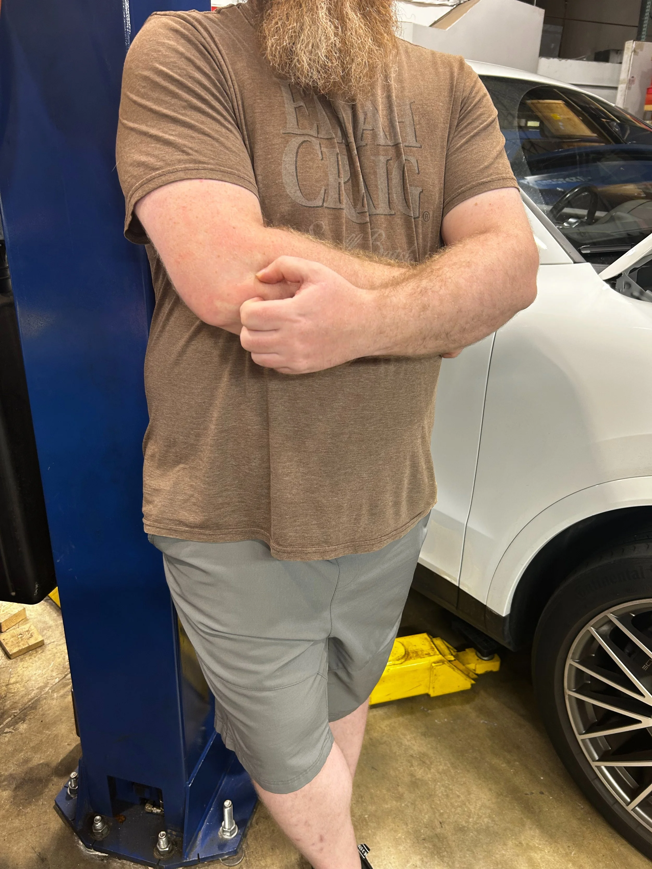 A person experiencing the proud elbow effect.