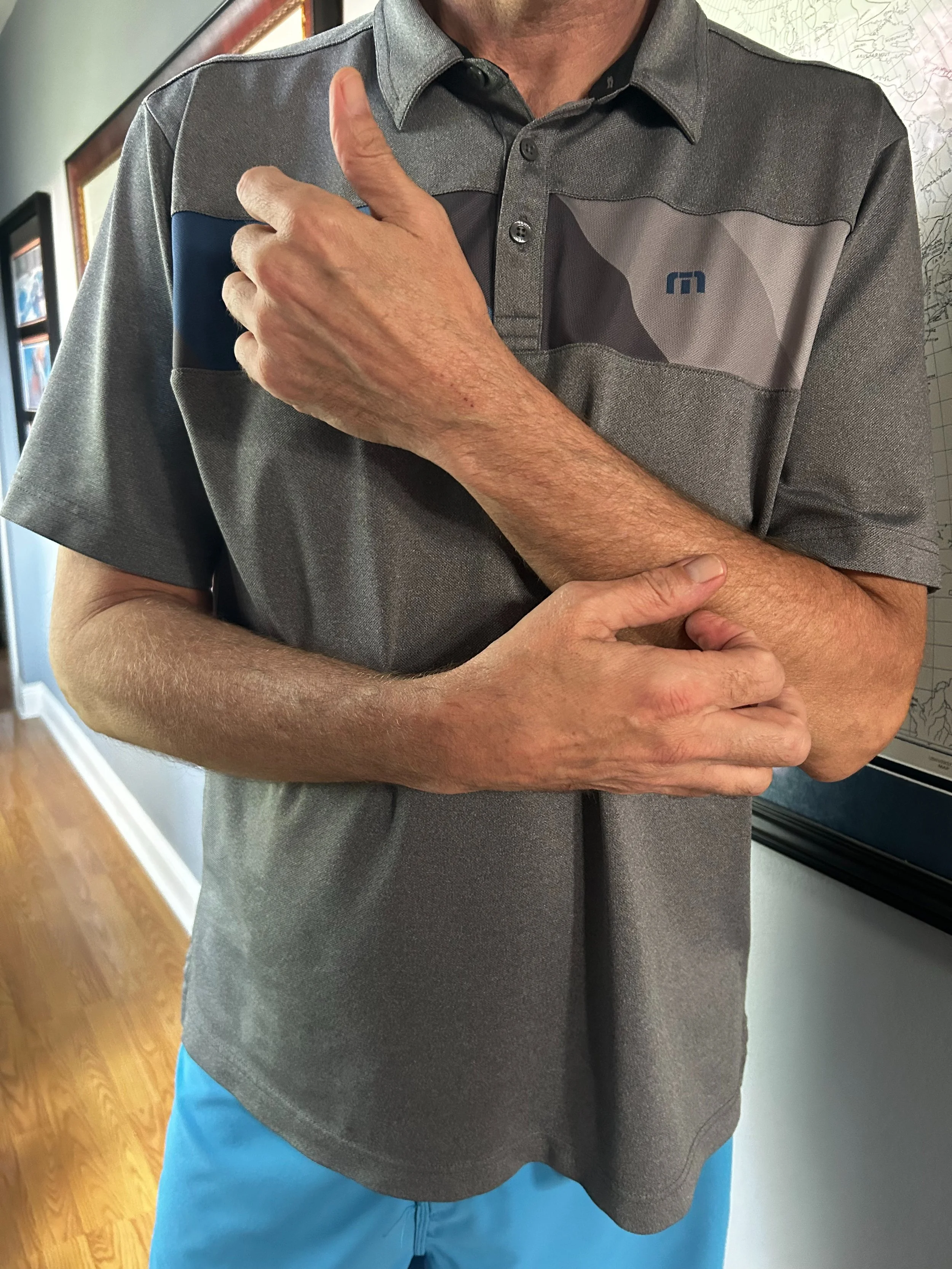 Proud Elbow.jpeg