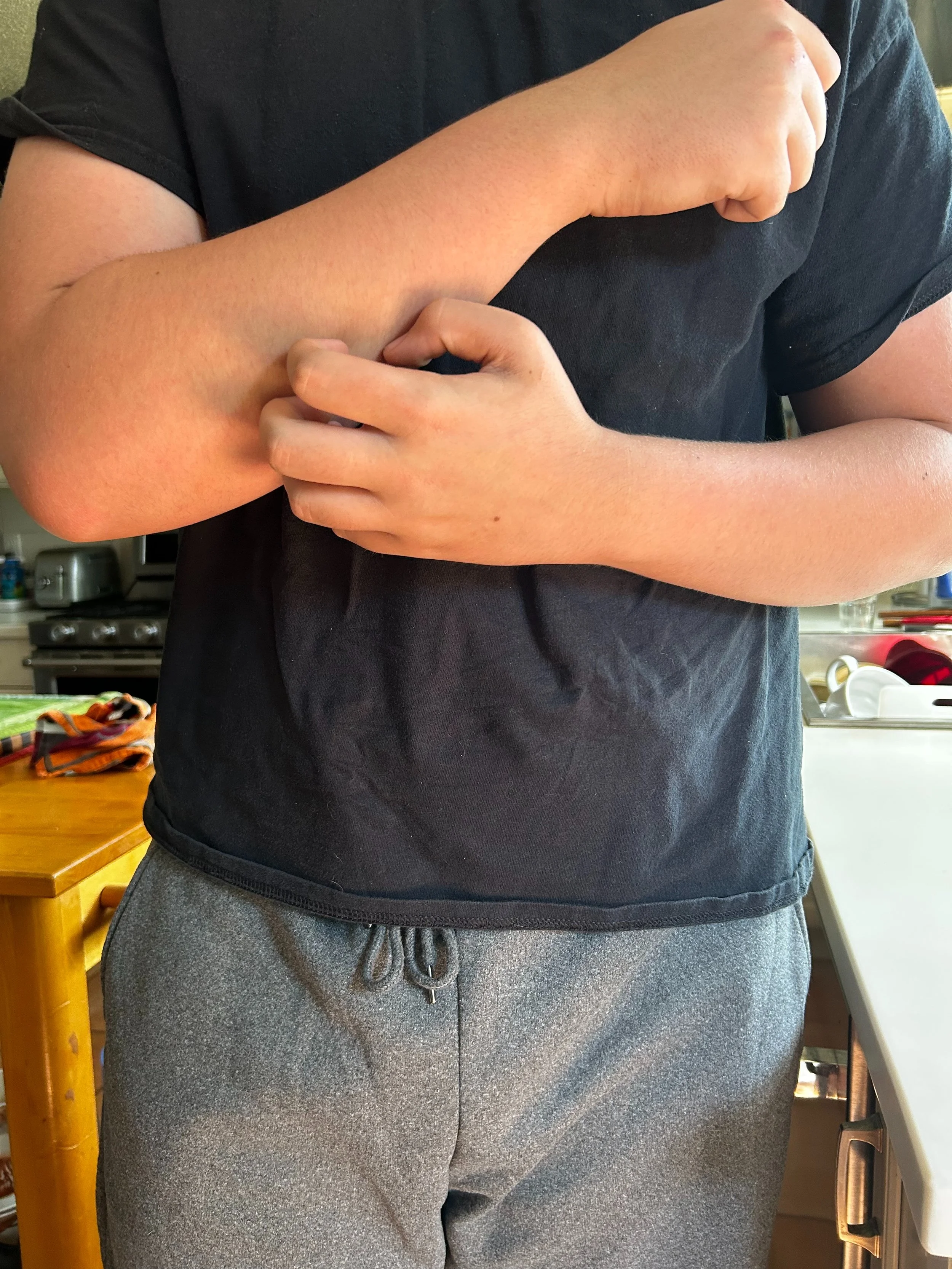 Proud Elbow 722.jpeg