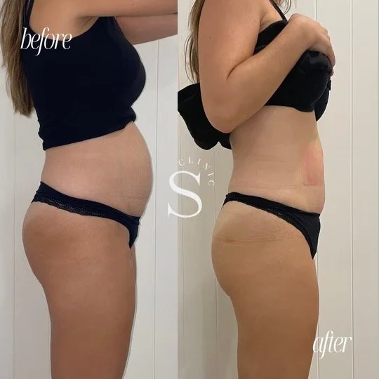 BEFORE AND AFTER TEMPLATE.JPG