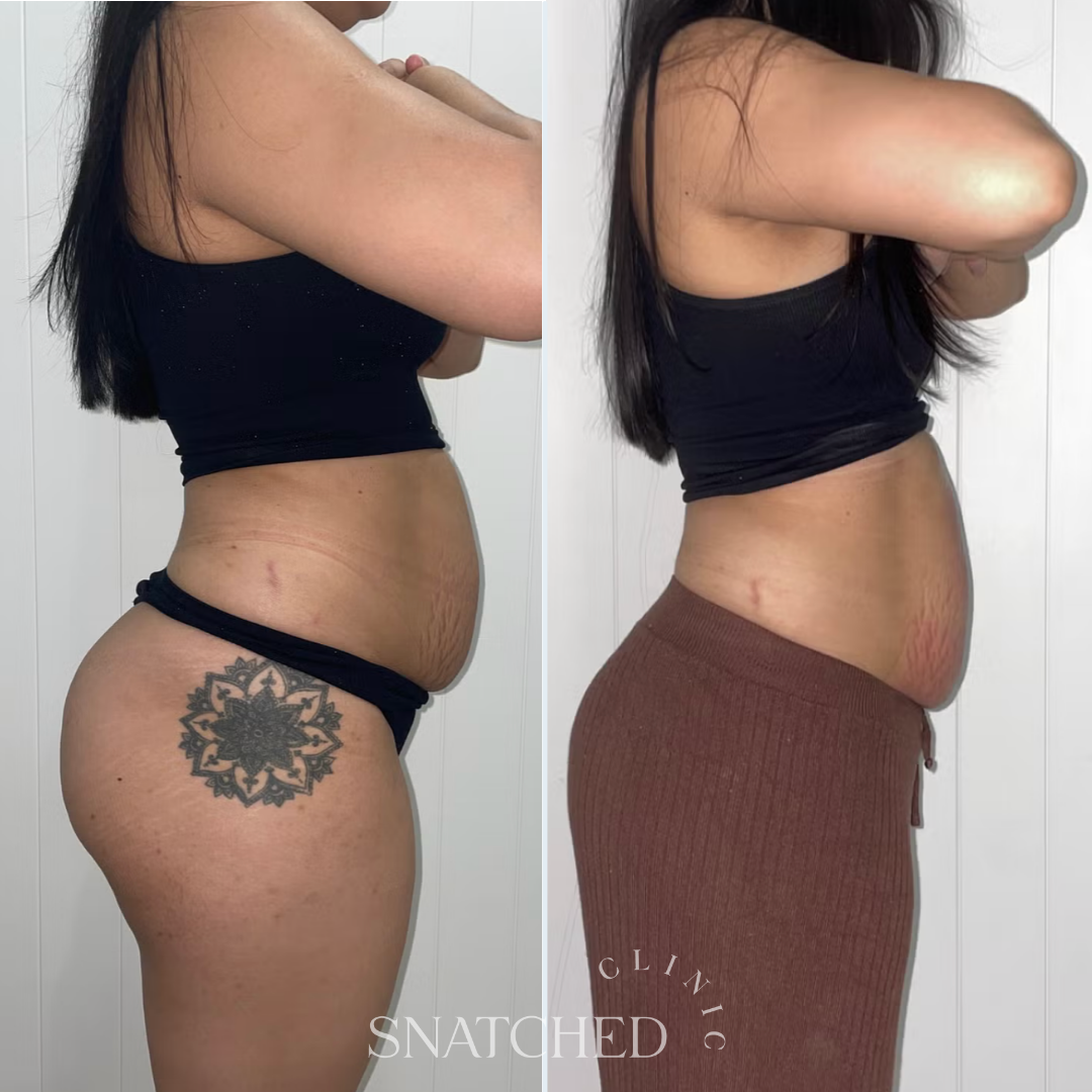 Minimal Photocentric Before and After Instagram Post (5).png