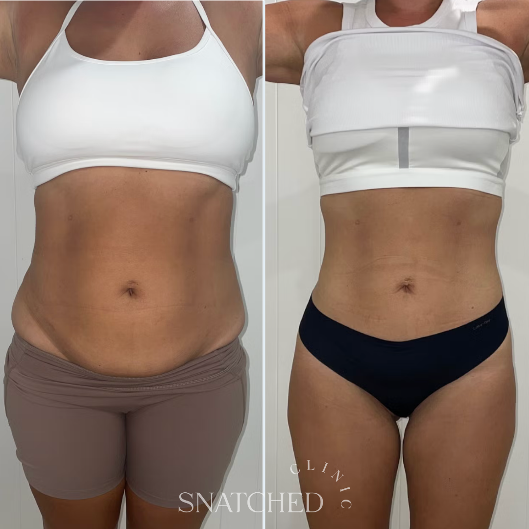 Minimal Photocentric Before and After Instagram Post (10).png