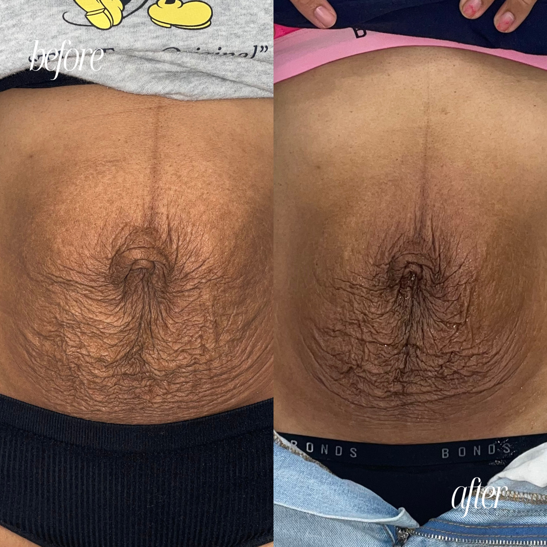 Copy of BEFORE AND AFTER TEMPLATE - 4.png