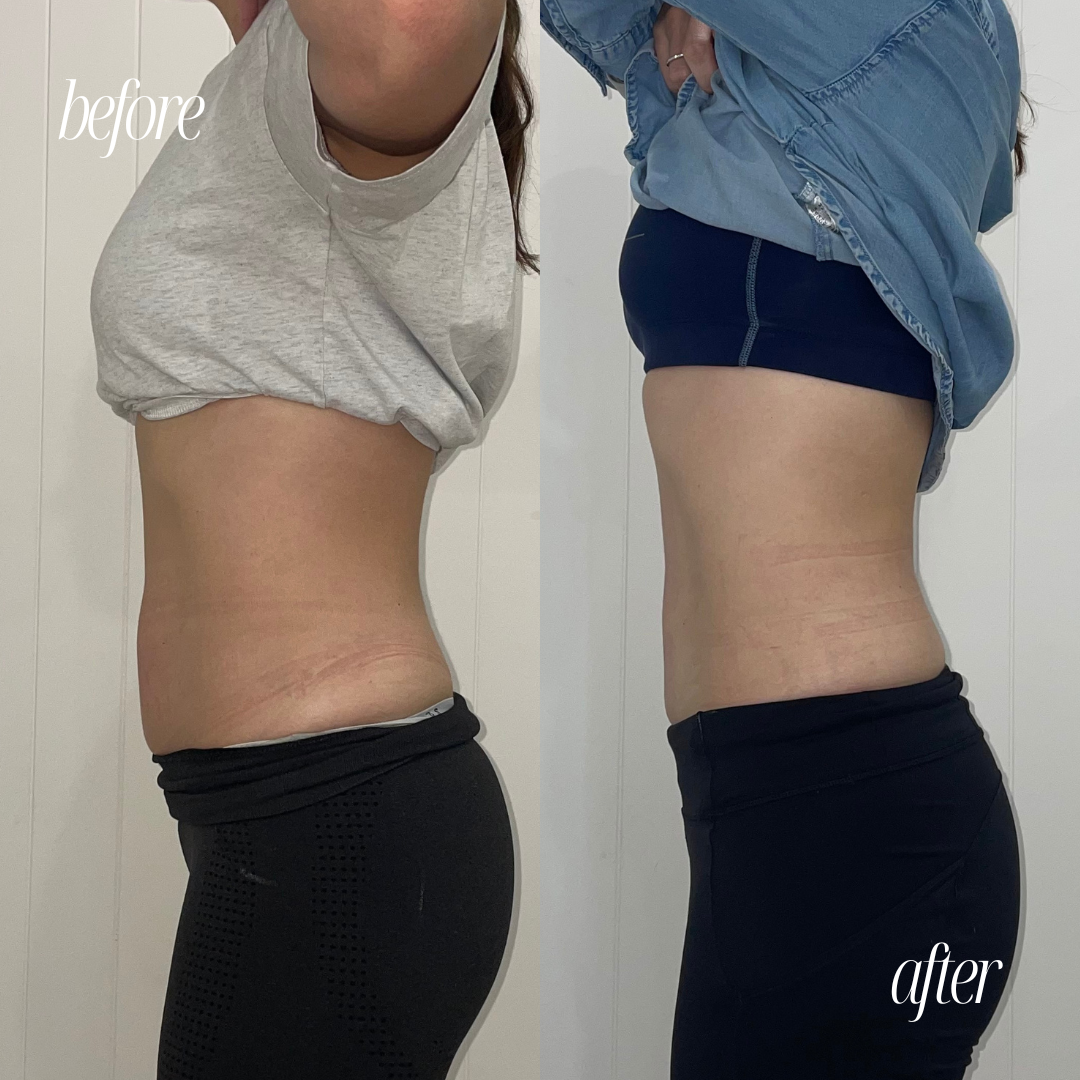 Copy of BEFORE AND AFTER TEMPLATE - 5.png