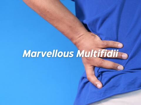 Marvellous Multifidii