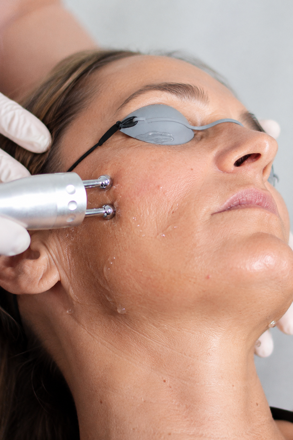 A woman receiving a facial treatment with a laser device while wearing eye protection.