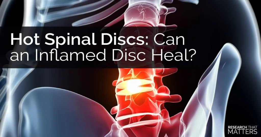 Hot Spinal Discs: Can an Inflamed Disc Heal?