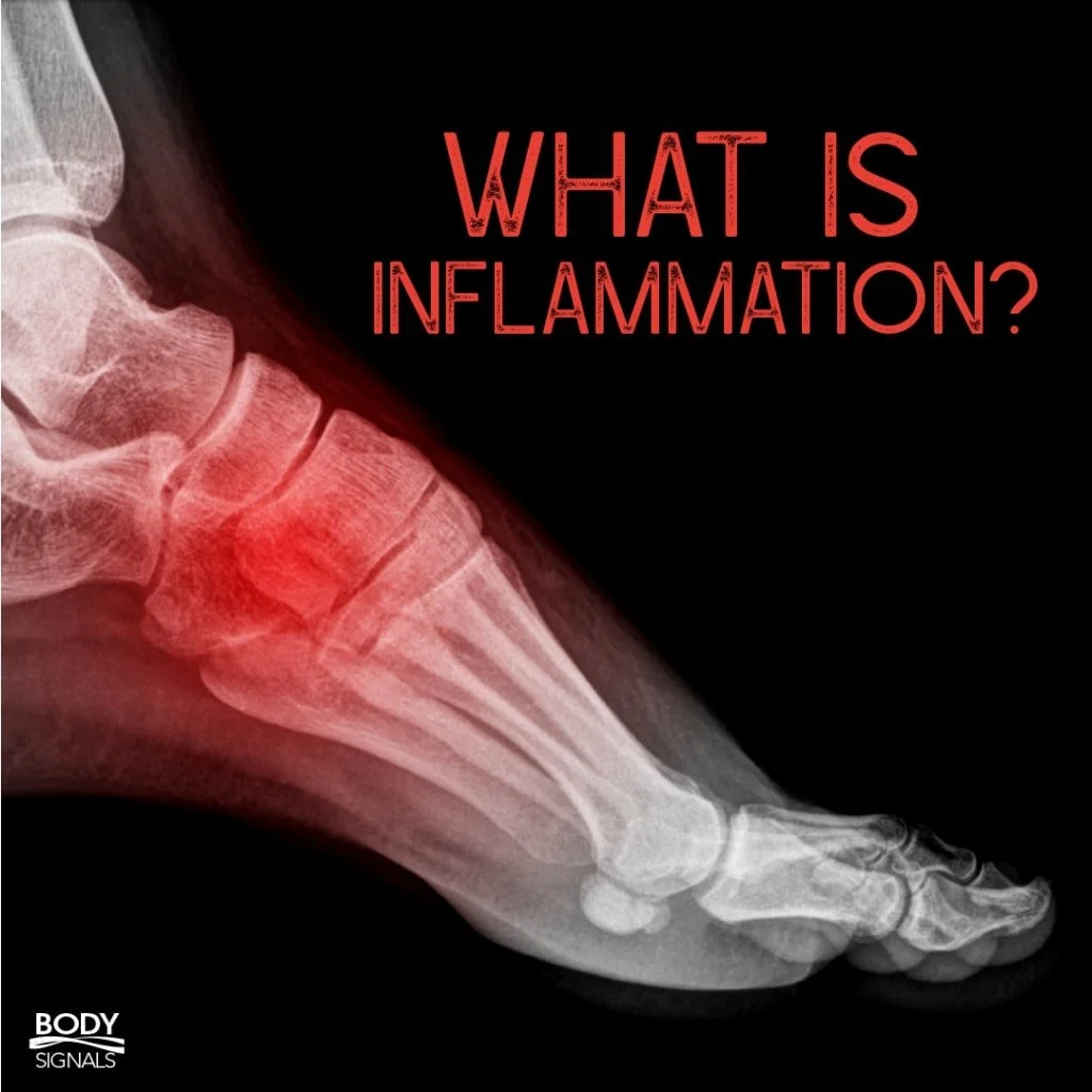 CHRONIC INFLAMMATION - Are You Suffering?