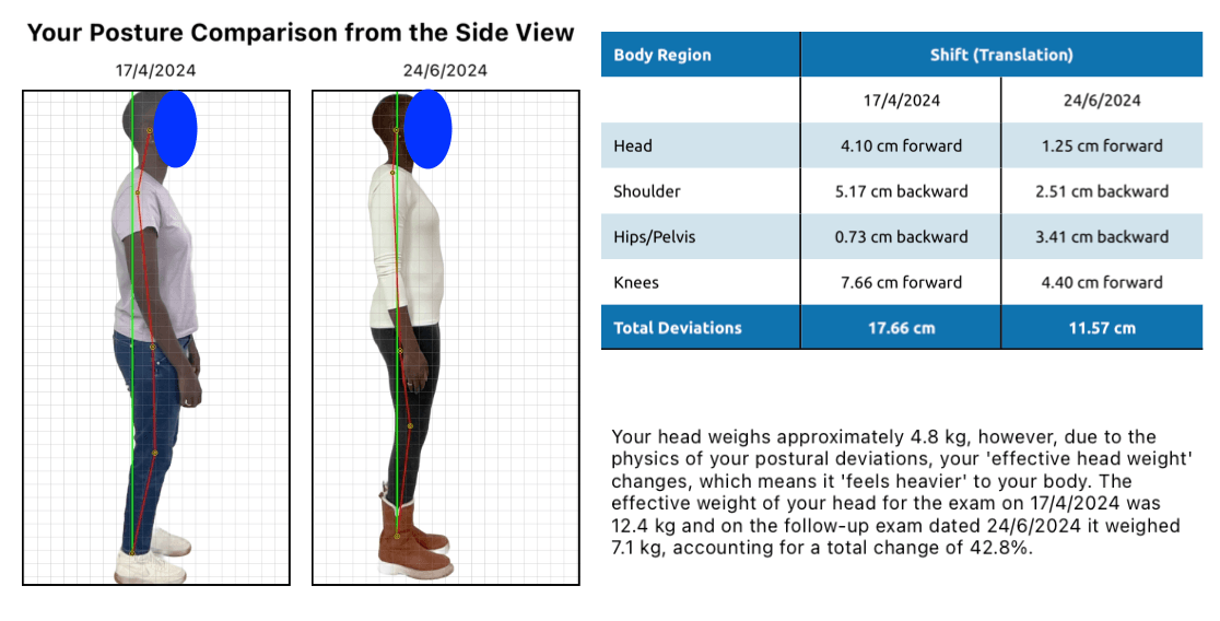 Tech Neck Treatment Chatswood - Family Chiropractic