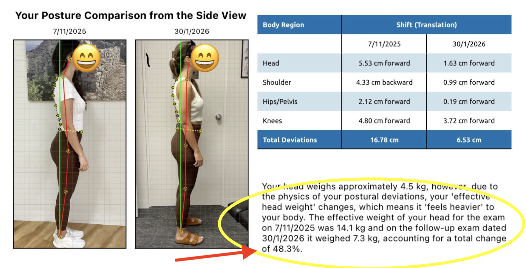 Posture &amp; Headaches: The Research-Backed Connection | Chatswood Chiro