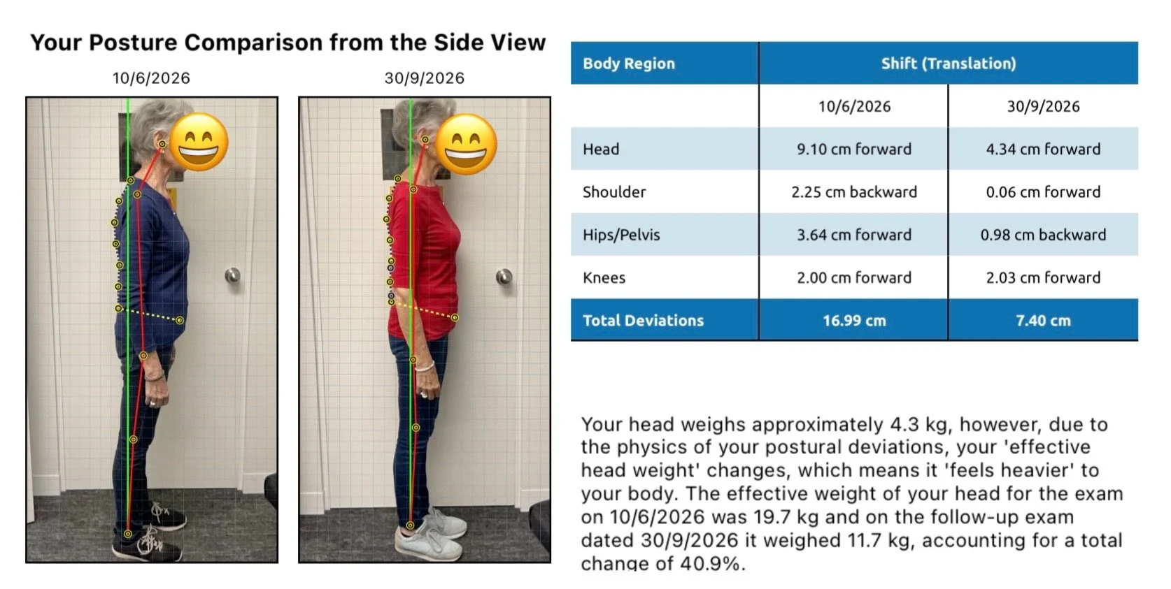 Does Your Posture Affect How Long You Live? The Link Between a Rounded Upper Back, Breathing and Healthy Ageing