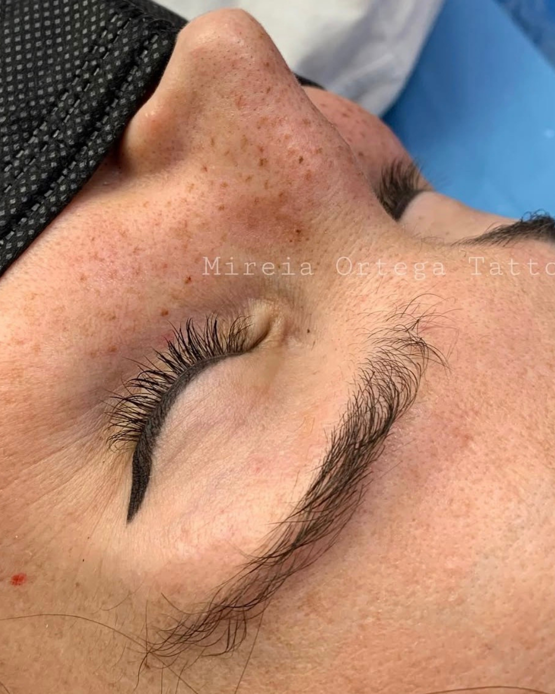 Detalle de pecas realizadas mediante micropigmentación
