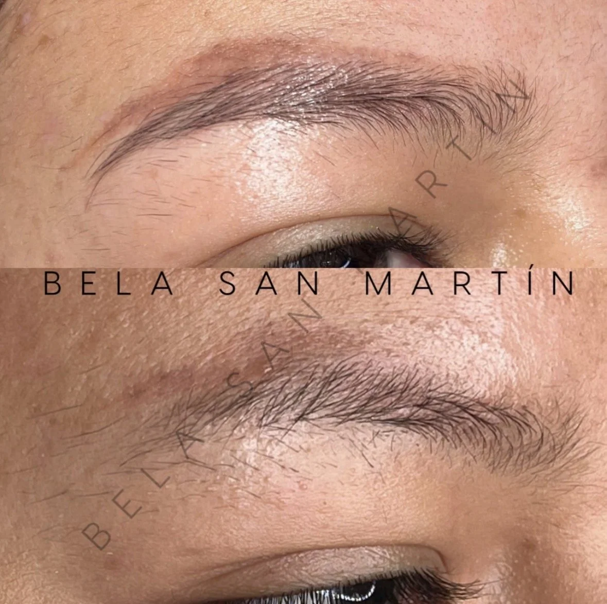 eliminación láser micropigmentación en cejas en purezas tattoo gandía