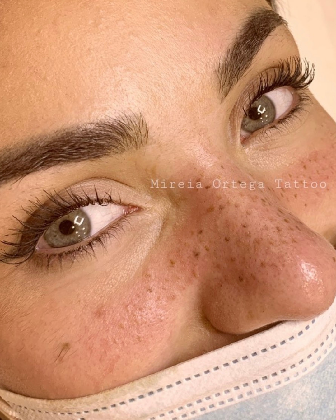 Micropigmentación de pecas con resultado natural purezas tattoo gandia