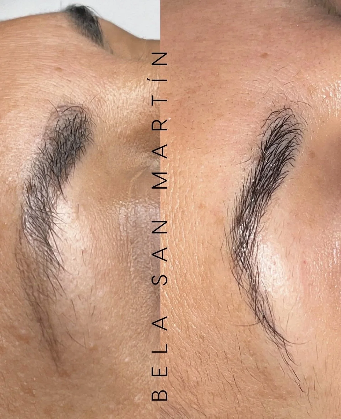 eliminación láser micropigmentación cejas 2 en purezas tattoo gandía