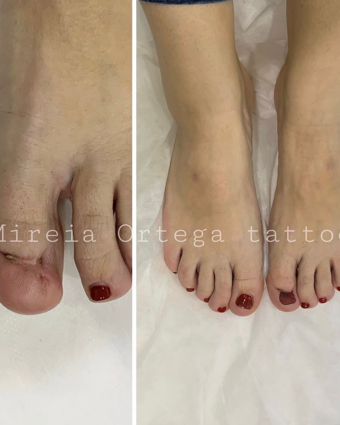 Reconstrucción estética mediante tatuaje en Purezas Tattoo Gandía