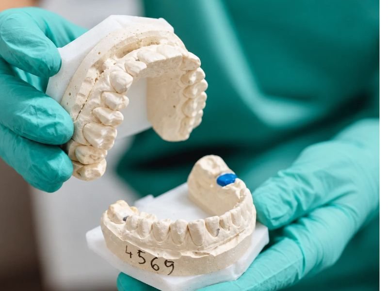 Dentures