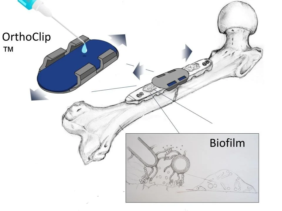 Images for Exec Summary - OrthoClip.pptx.jpg