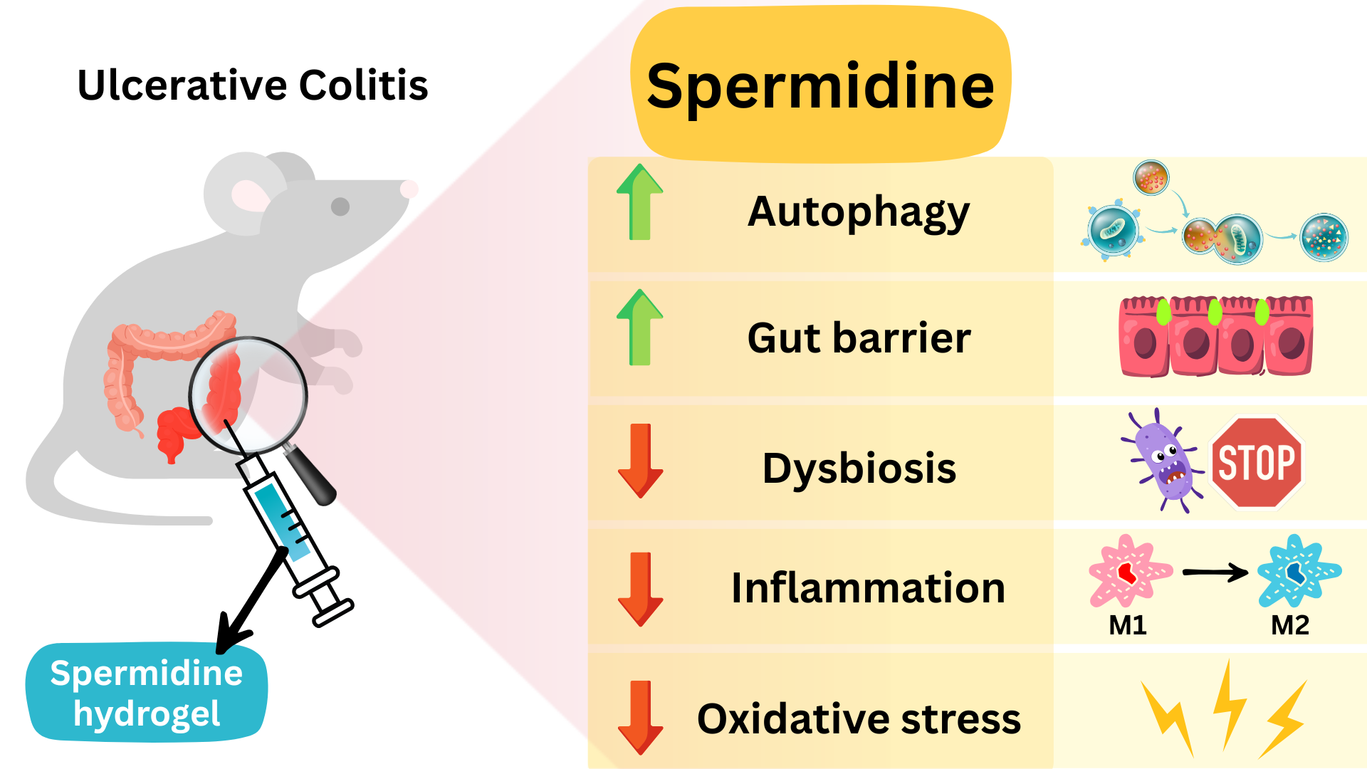 Spermidine vs Ulcerative Colitis.png