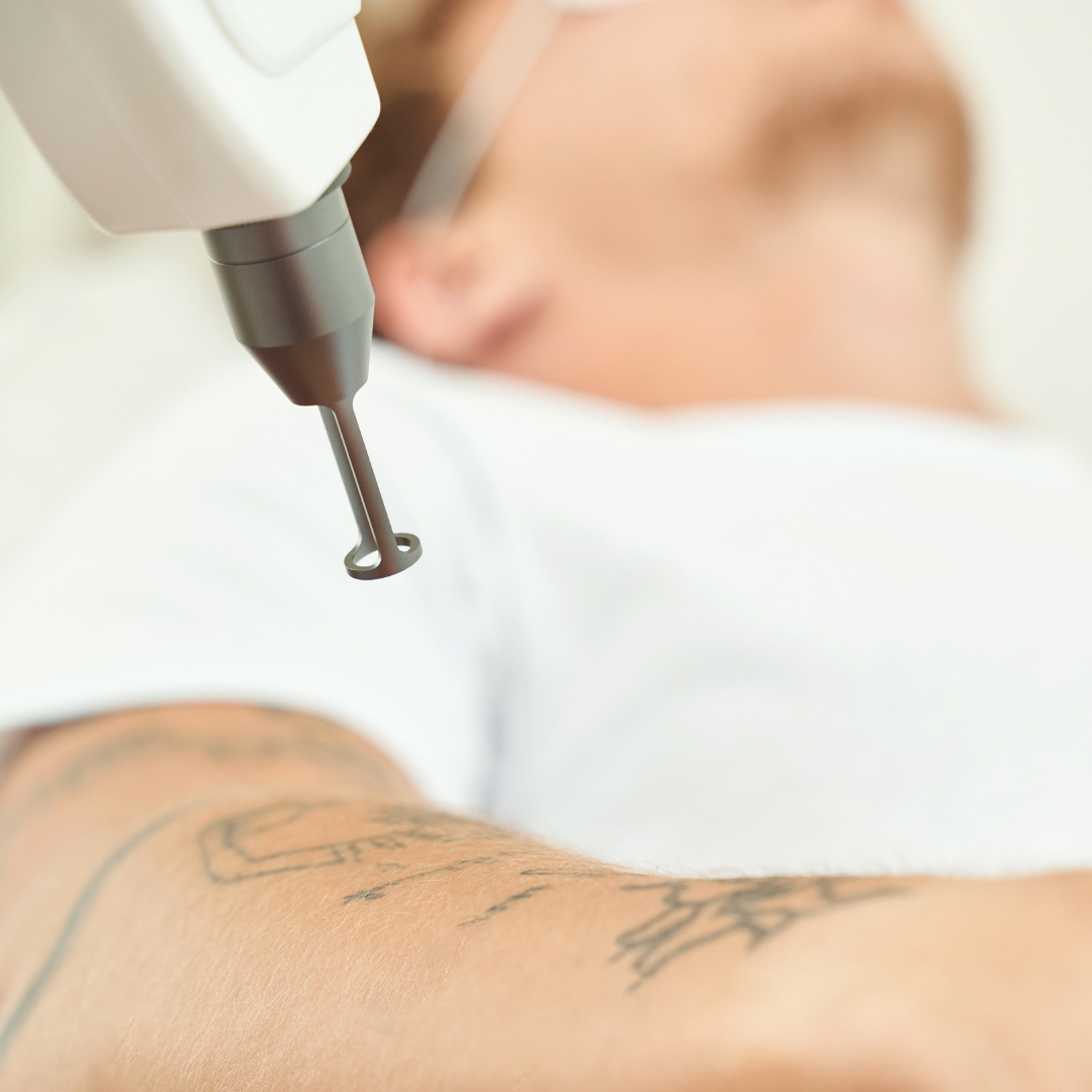 Medspa in Wausau, WI, 54403 | Tattoo Removal Near Me