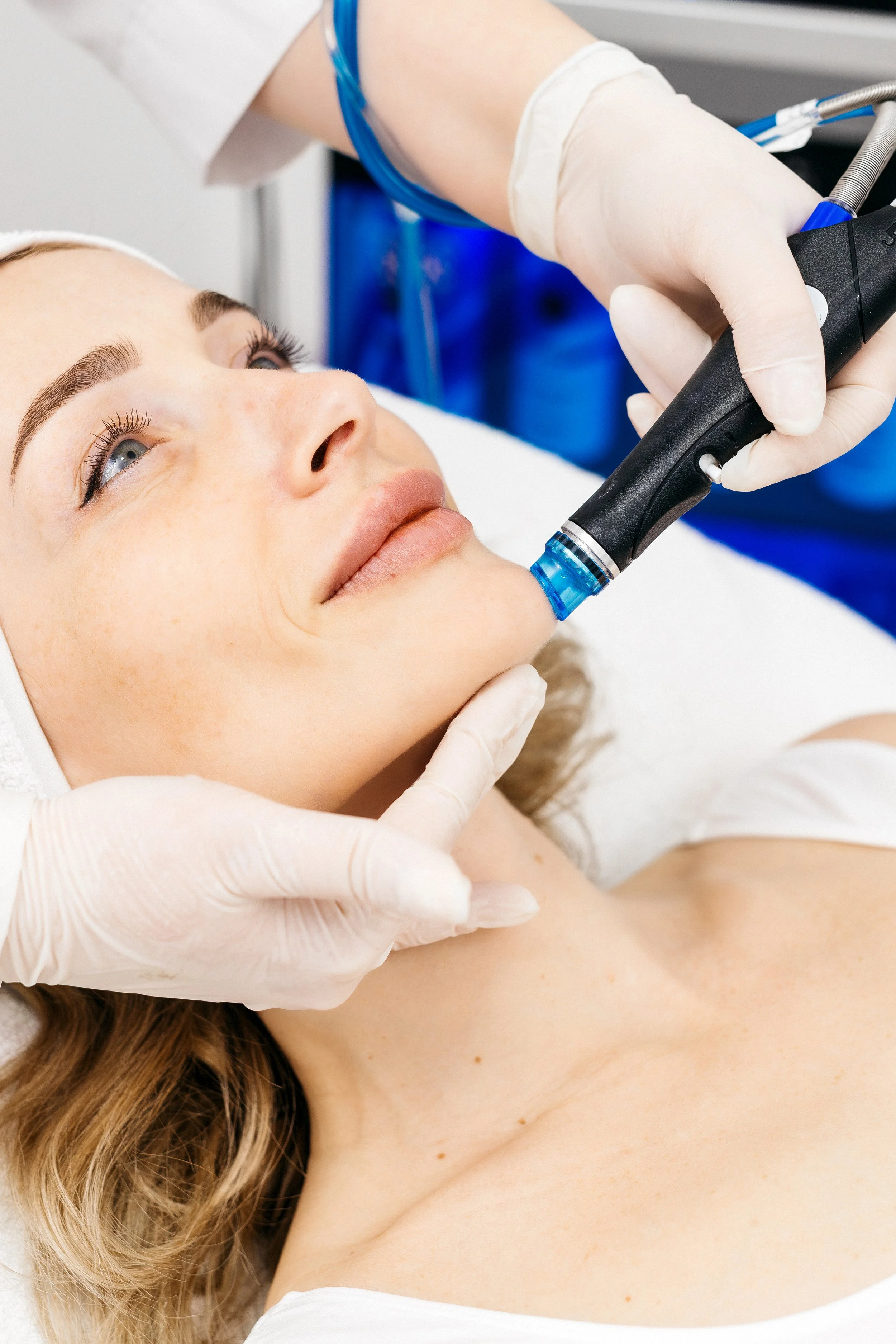 Medspa in Wausau, WI, 54403 | Microneedling Near Me