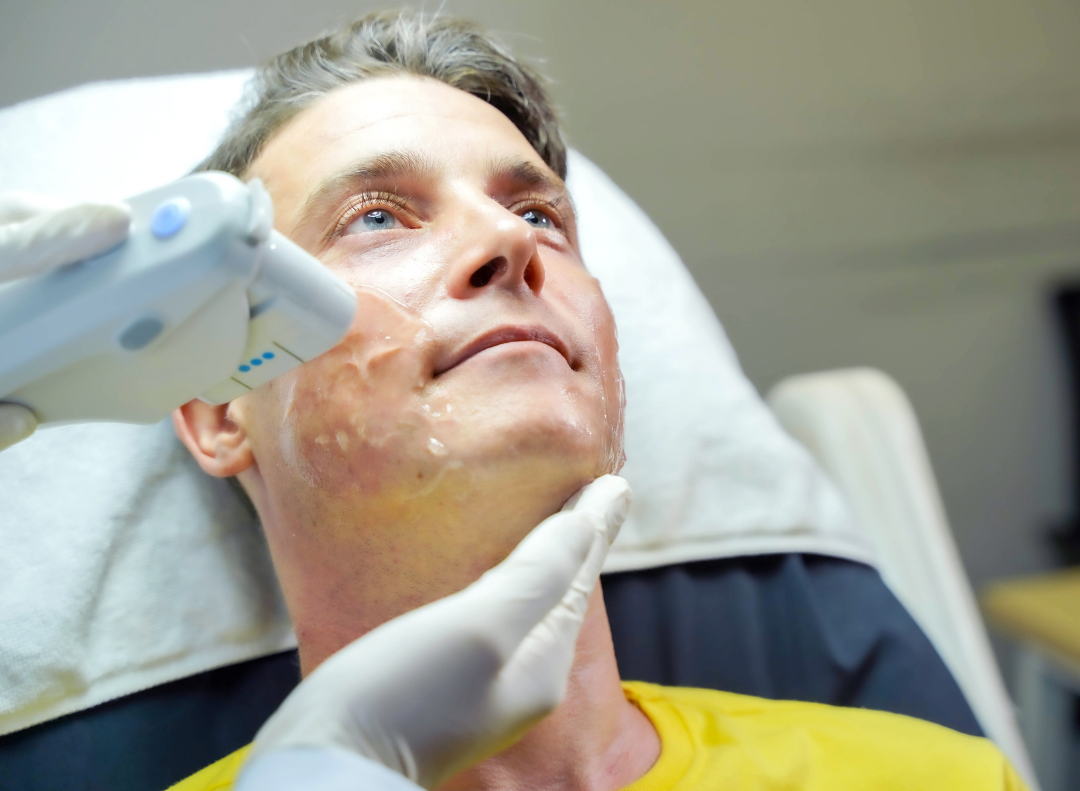 Medspa in Wausau, WI, 54403  IPL Near Me