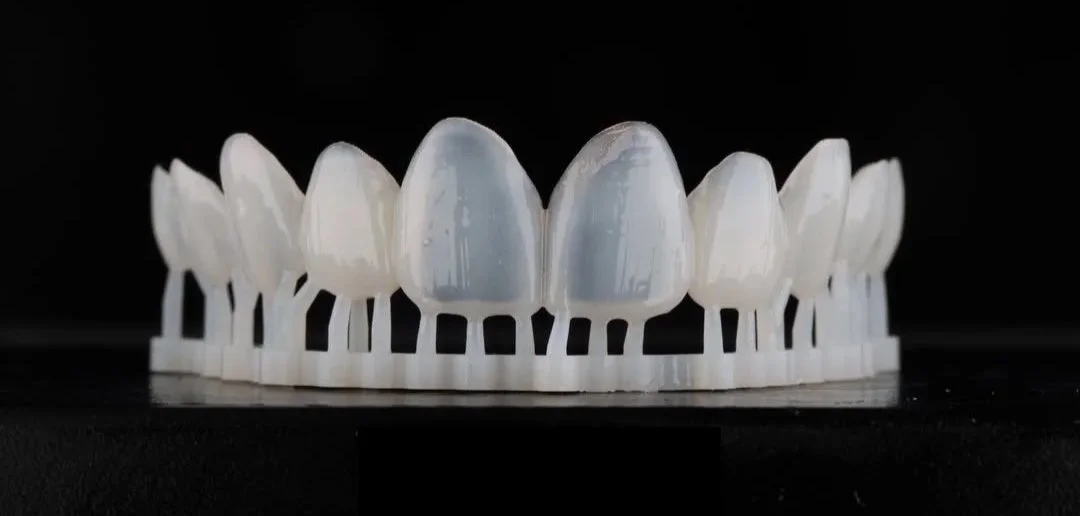 3DVNR™ process - REVEAL™ 3D printed prototype "trial smile."