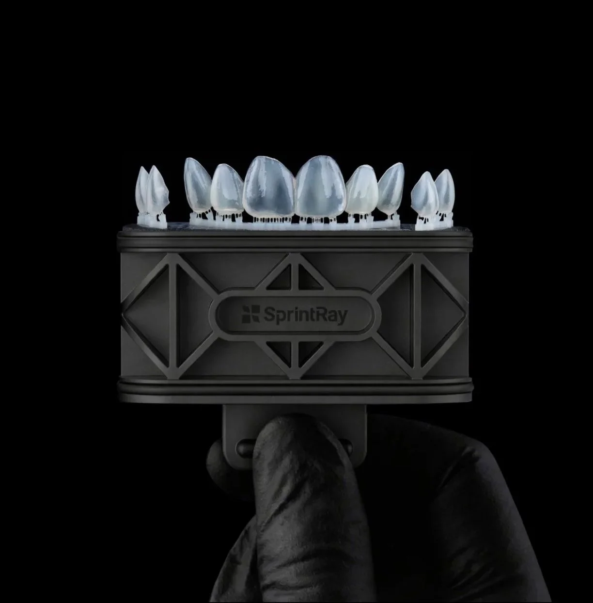 Sprintray 3D printed no prep porcelain veneers