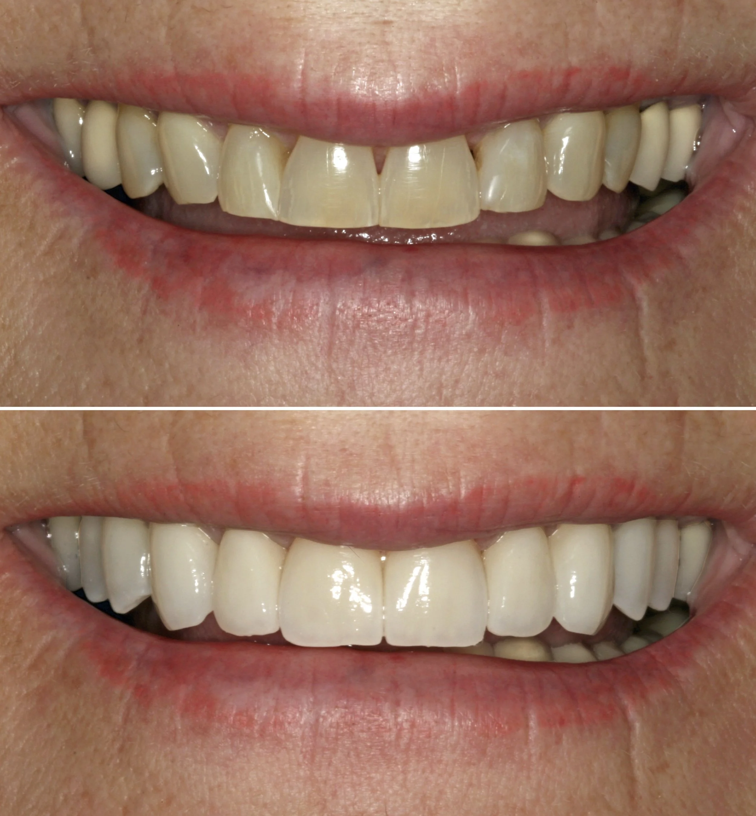 3DVNR™ case 04 - discoloration