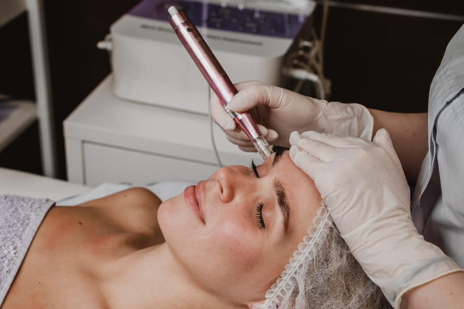 Medspa in Bakersfield, CA, 93311 | Microneedling Near Me