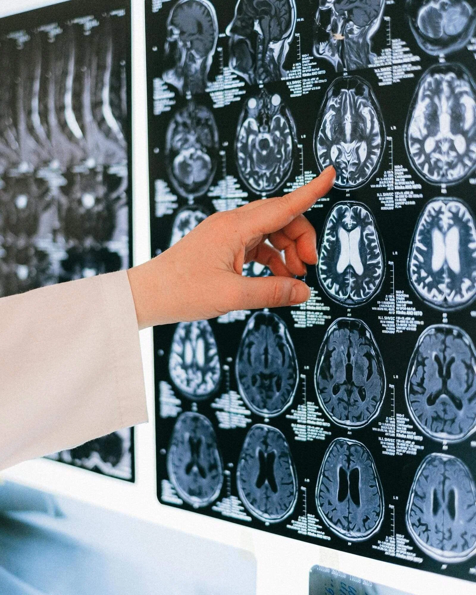 Finger pointing at a slide of brain scans