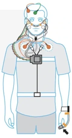 Medical diagram of a human with connected sensors and medical devices attached, including electrodes on the head, chest, and arms, and monitoring equipment on the wrist and waist.