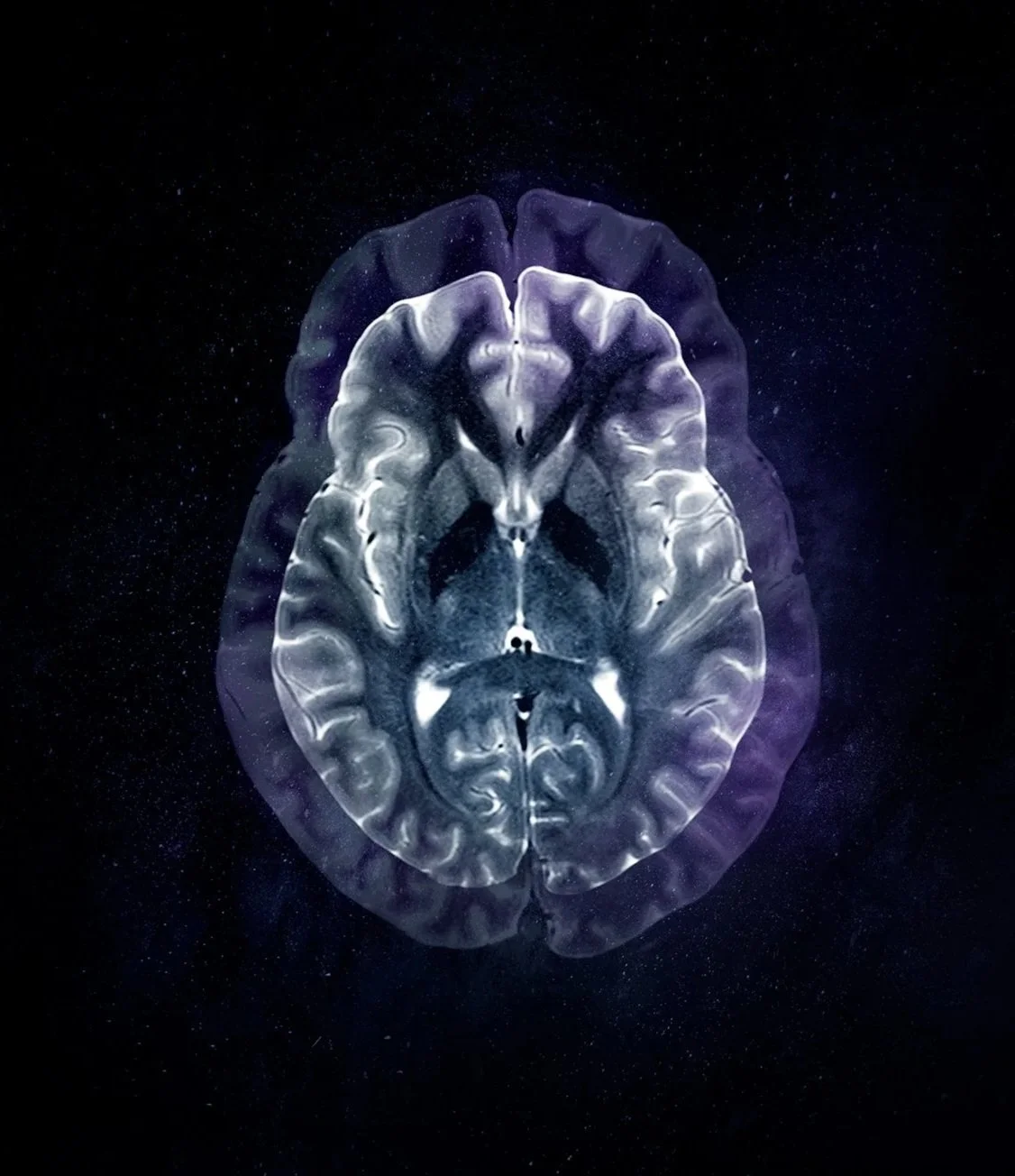 Une image artistique représentant un cerveau en forme de galaxie dans l'espace, avec un effet lumineux et sombre.