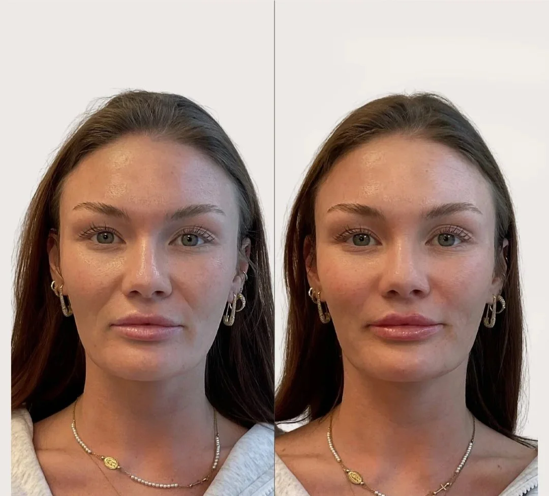 Facial Balancing
