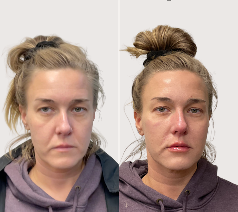 Ellen+Aldrich+full+face+-+2.png