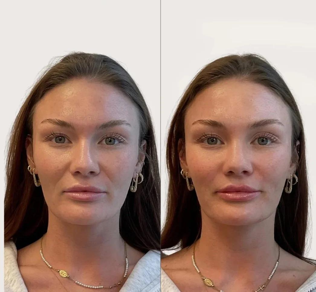 Full Facial Balancing