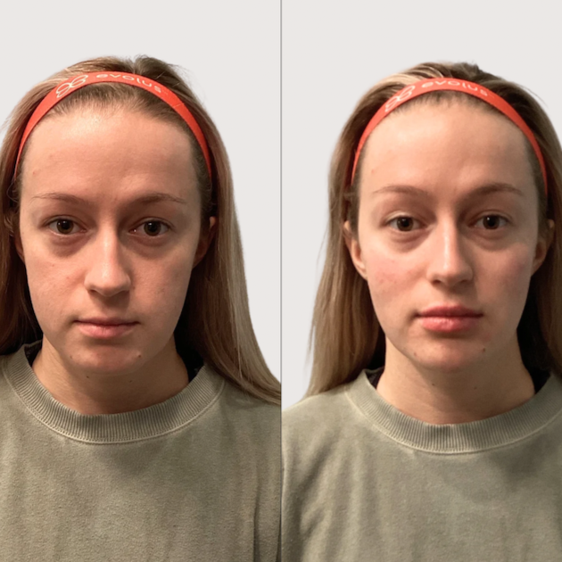 Jill+before+and+after+-+1.png