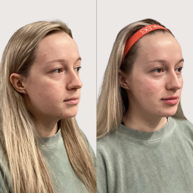 Jill+before+and+after+-+2.png