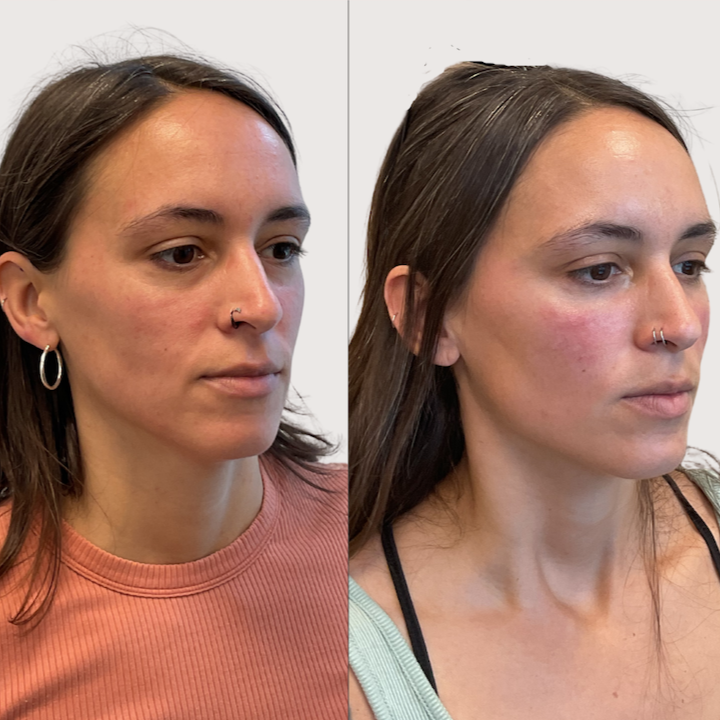 Ashleigh+wormer+filler+model+-+3.png