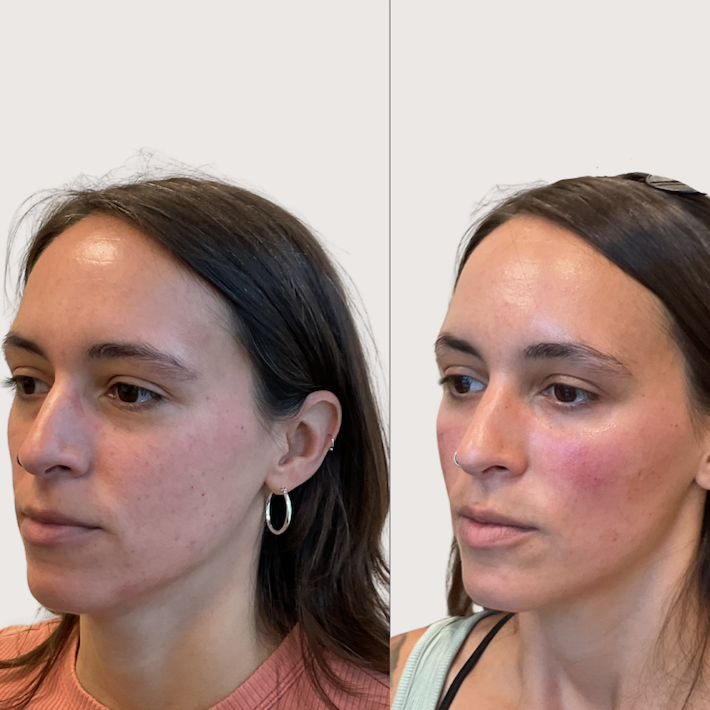 Ashleigh+wormer+filler+model+-+2.png