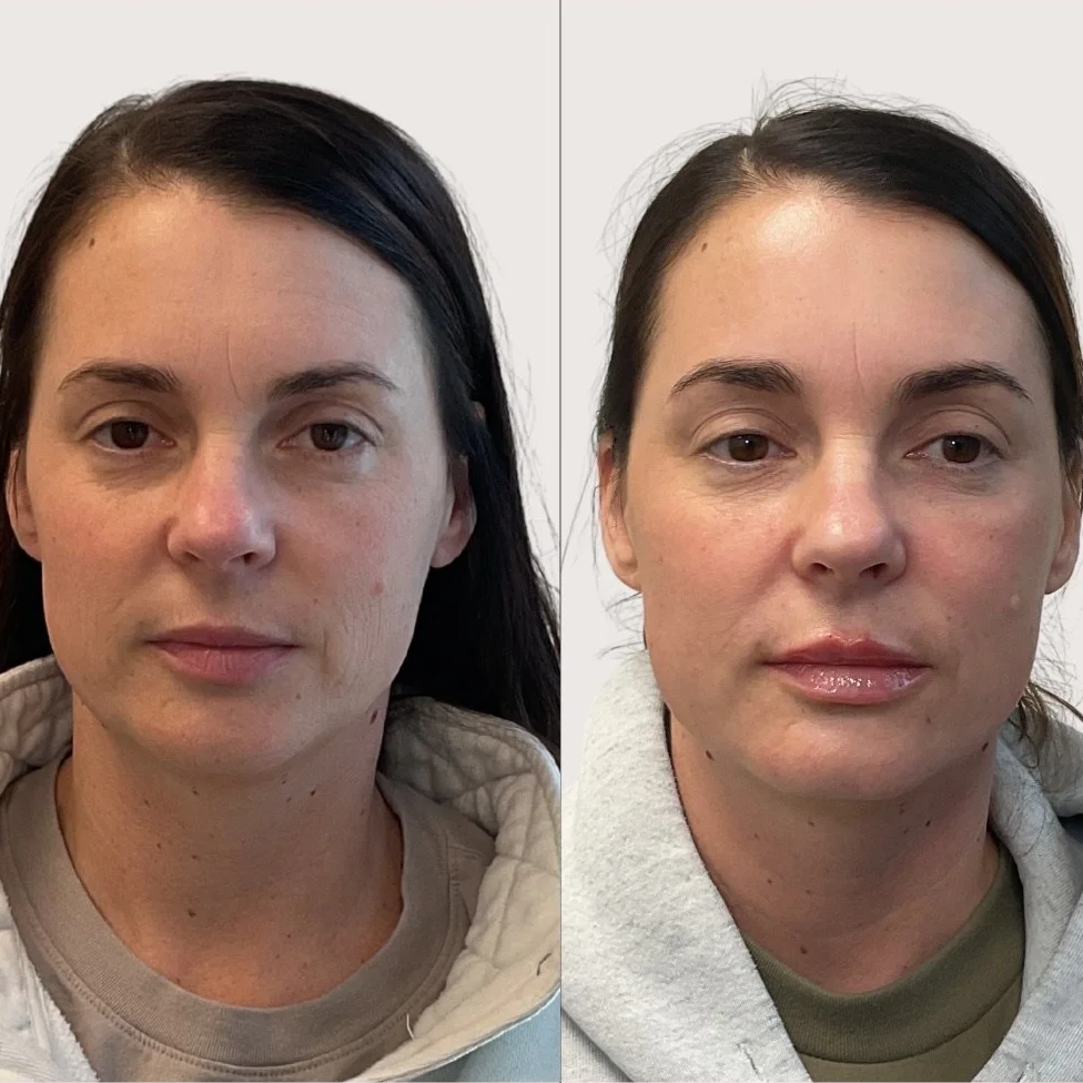 facial+balancing.png