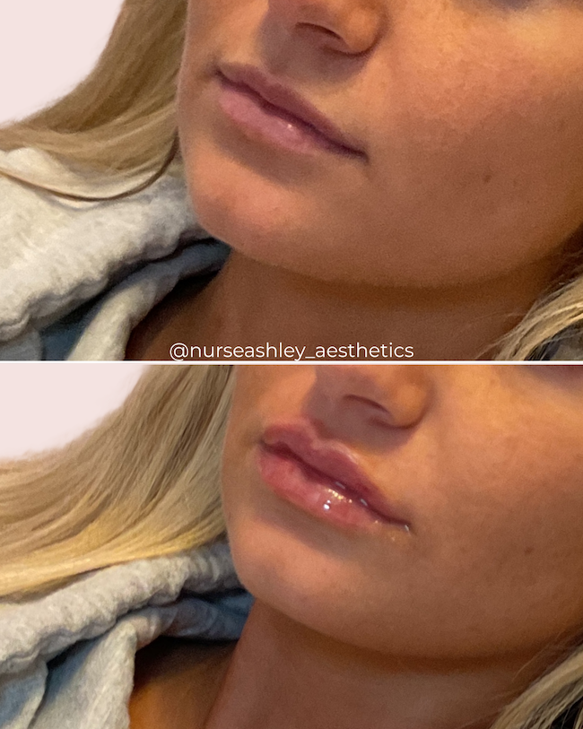 Joanna Mcklusky lips.png