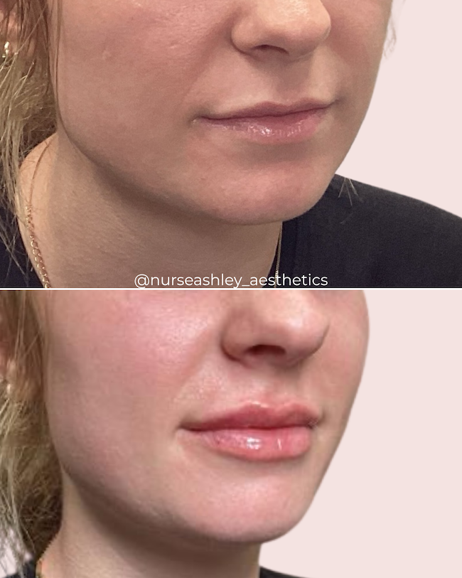 Taylor K lips - 2.png