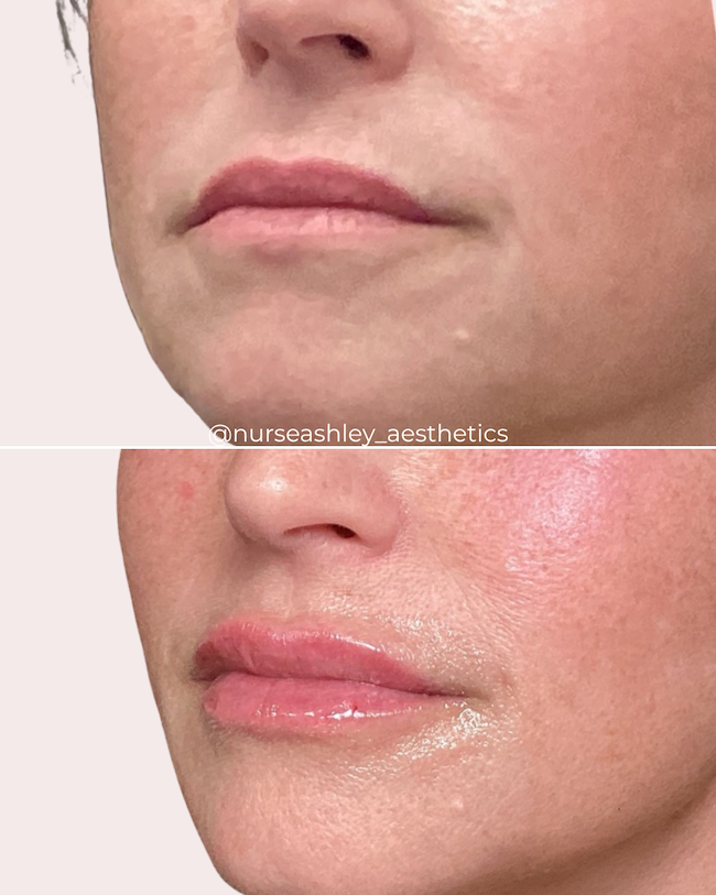Robyn lips (Cathy friend).png