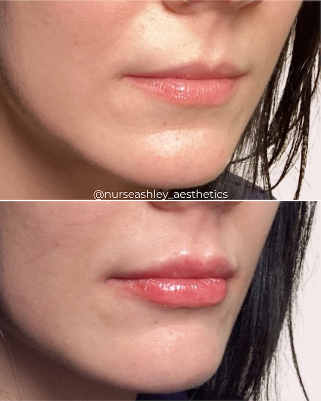 Josie Channell lips - 2.png