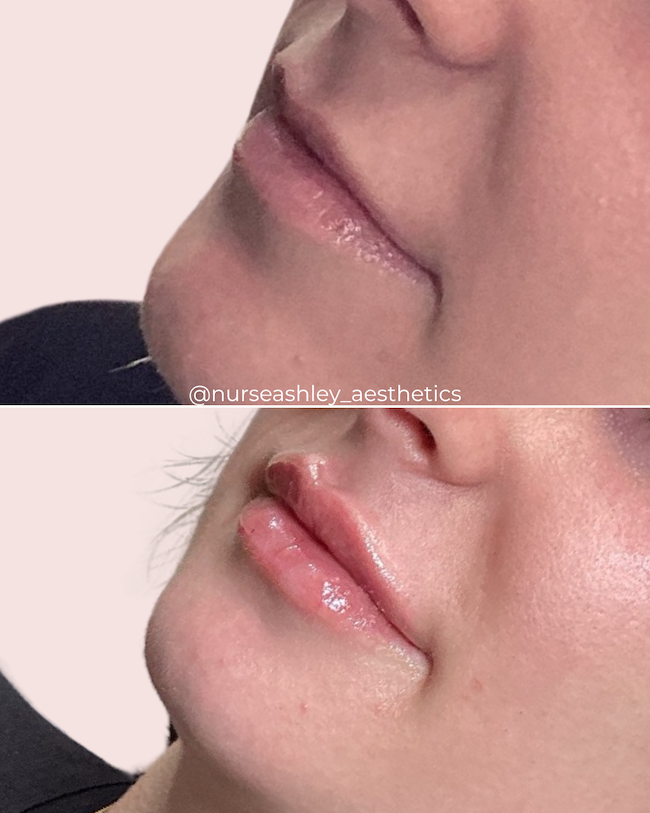 Taylor K lips - 4.png